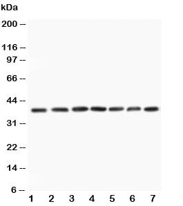 Western blot testing of MEK3 antibody and Lane 1: rat skeletal muscle; 2: rat kidney; 3: rat spleen;