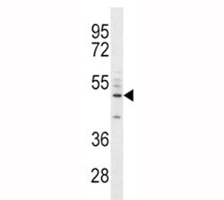 CD14 antibody western blot analysis in A549 lysate. Predicted size 40-55 kDa depending on glycosylat