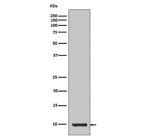 Western blot testing of recombinant partial protein with IGF1 antibody.