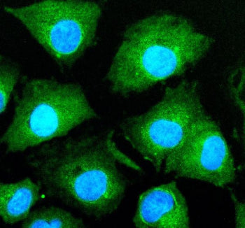 Immunofluorescent staining of HJURP using anti-HJURP antibody (green). HJURP was detected in an immu