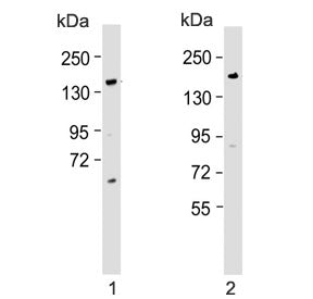 Western blot testing of human 1) HL60 and 2) Caco-2 lysate with BCORL1 antibody. Predicted molecular