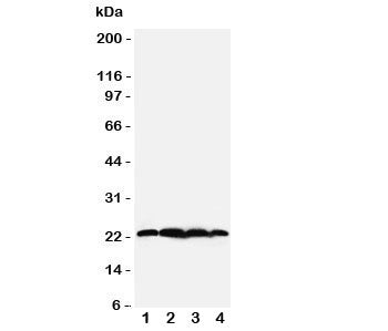 BAG2 Antibody