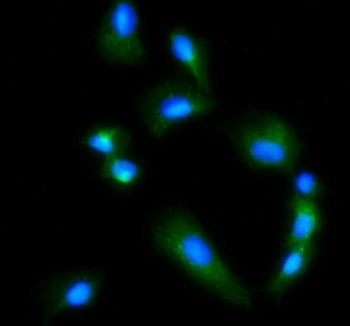 Immunofluorescent staining of FFPE human U-2 OS cells with GLS antibody (green) and DAPI nuclear sta