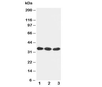 Western blot testing of DKK1 antibody and Lane 1: U87; 2: MCF-7; 3: A549 cell lysate. Predicted mole