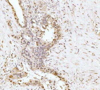 EXOSC2 Antibody / RRP4