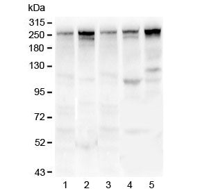 Western blot testing of 1) rat lung, 2) mouse lung, 3) human U-87 MG, 4) human MDA-MB-231 and 5) hum
