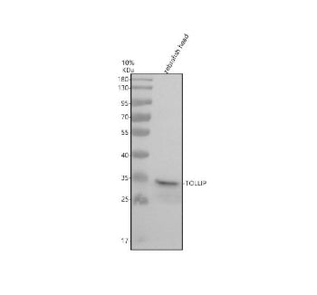 Western blot analysis of Tollip protein using Tollip antibody and zebrafish head tissue lysate. The 