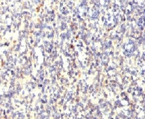 TRAcP Antibody / TRAP / ACP5