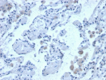 Cystatin B Antibody / CSTB / Stefin B
