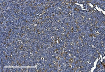 IHC staining of FFPE human tonsil with PNPT1 antibody. HIER: boil tissue sections in pH8 EDTA for 20