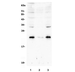 Western blot testing of human 1) Caco-2, 2) HepG2 and 3) A549 cell lysate with Rab8 antibody. Predic