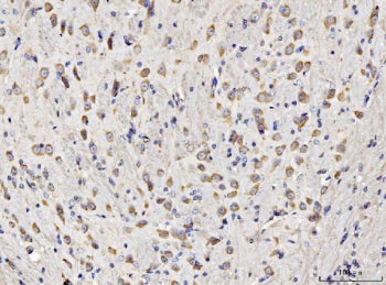 RPL11 Antibody / 60S ribosomal protein L11