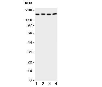 Western blot testing of cPLA2 antibody and Lane 1: rat testis; 2: (r) brain; 3: human A549; 4: (h) C