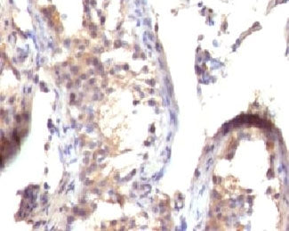 TGF alpha Antibody