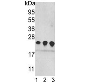 Western blot testing of 1) human MDA-MB-231, 2) HEK293 and 3) mouse brain lysate with PRDX2 antibody