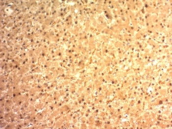 Glypican 3 Antibody / GPC3