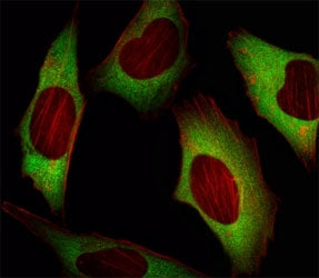 EIF4E Antibody, 0.08ml