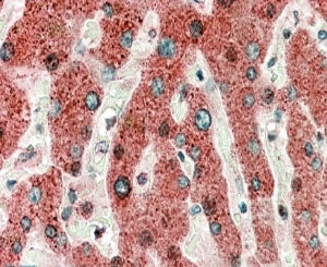 IHC testing of FFPE human liver with HRASLS2 antibody at 5ug/ml. HIER: microwaved with pH9 Tris/EDTA