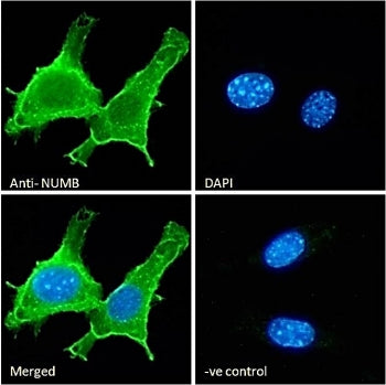 NUMB Antibody