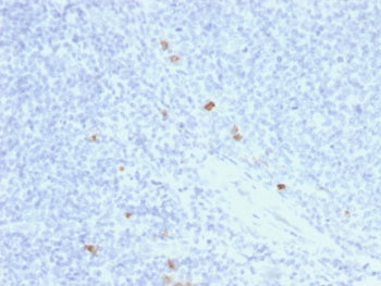 IHC testing of FFPE human tonsil with recombinant IgG4 antibody (clone rIGHG4/1345). HIER: boil sect