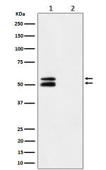 Phospho-CaMKII alpha (Thr286) western blot of mouse brain using Phospho-CaMKII alpha (T286) antibody
