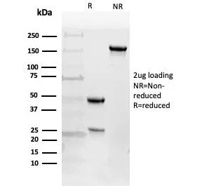 SDS-PAGE analysis of purified, BSA-free EGFR antibody (clone 225) as confirmation of integrity and p