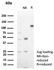 CD48 Antibody (Pan Leukocyte Marker)