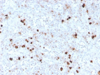 IHC staining of FFPE human spleen with recombinant IgM antibody (clone IGHM/3776R). HIER: boil tissu