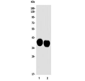 Western blot testing of 1) rat brain and 2) mouse brain tissue lysate with Mtnd2 antibody. Predicted