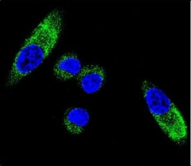 Confocal immunofluorescent analysis of CYP1A1 antibody with MDA-MB231 cells followed by Alexa Fluor 