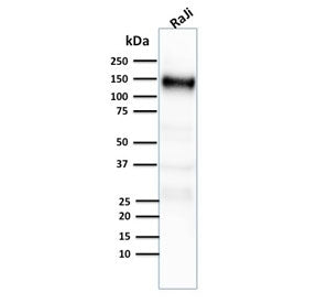 Western blot testing of human Raji cell lysate with CD21 antibody (clone CR2/2754).