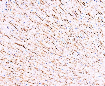 IHC-P: MAP1 antibody testing of rat brain tissue. HIER: steamed with pH6 citrate buffer, HRP-stainin