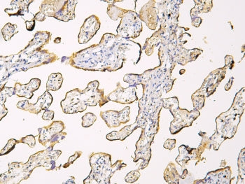 Haptoglobin Antibody