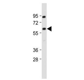Western blot testing of human MOLT4 cell lysate with YY1 antibody. Predicted molecular weight ~45 kD
