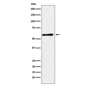 Western blot testing of human fetal brain lysate with PAK3 antibody. Predicted molecular weight ~62 