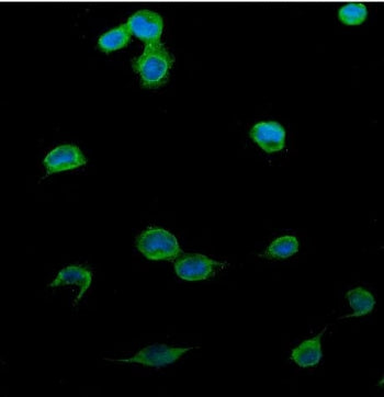 Immunofluorescent staining of FFPE human U-2 OS cells with Patched 2 antibody (green) and DAPI nucle