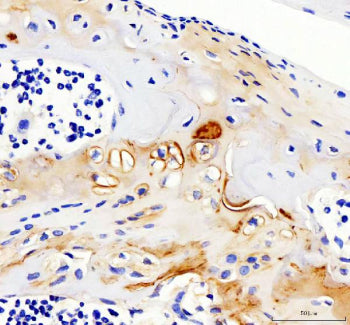 Immunohistochemical staining of Collagen Type II/COL2A1 using anti-COL2A1 antibody. Collagen Type II