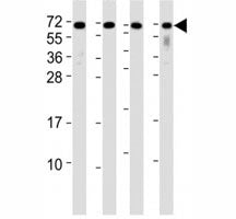 Western blot testing of CD63 antibody at 1:2000 dilution. Lane 1: A2058 lysate; 2: A375 lysate; 3: T