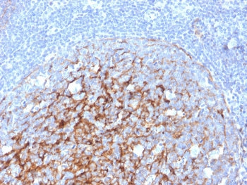 IHC staining of FFPE human tonsil with CD21 antibody (clone CR2/3247). HIER: boil tissue sections in