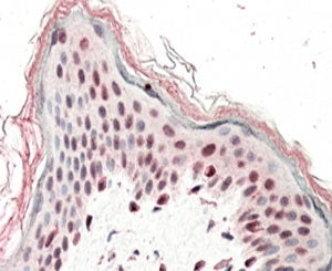IHC testing of FFPE human skin with SRCAP antibody at 5ug/ml. HIER: steamed with pH6 citrate buffer,