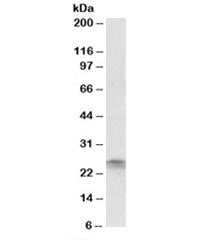 Western blot testing of Jurkat lysate with FGF8 antibody at 2ug/ml. Predicted molecular weight: ~25 