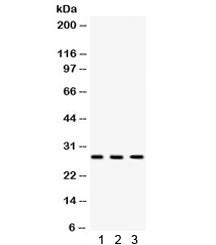 DKK2 Antibody