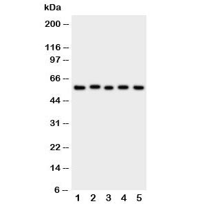 Western blot testing of ASIC3 antibody and Lane 1: rat brain; 2: (r) testis; 3: human U87; 4: mouse 