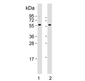 Western blot testing of human 1) HeLa and 2) HL60 cell lysate with Presenilin 1 antibody. Predicted 