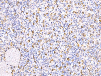 IHC staining of FFPE human spleen tissue with CD163 antibody at 1ug/ml. Required HIER: steam section