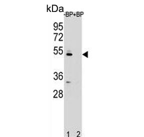 Western blot testing of human Ramos cell lysate in the absence and presence of immunizing/blocking p