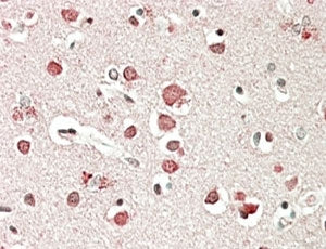 IHC staining of FFPE human cerebral cortex with Neurobeachin antibody at 5ug/ml. HIER: steamed with 