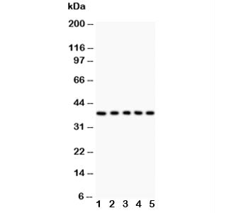 Western blot testing of Fas antibody and Lane 1: HeLa; 2: Jurkat; 3: A549; 4: SMMC-7721; 5: K562 lys