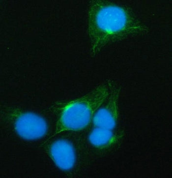 PRRT1 Antibody / Proline-rich transmembrane protein 1 / SynDIG4