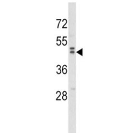 Western blot analysis of WNT10B antibody and human MDA-MB231 lysate. Predicted molecular weight ~45 